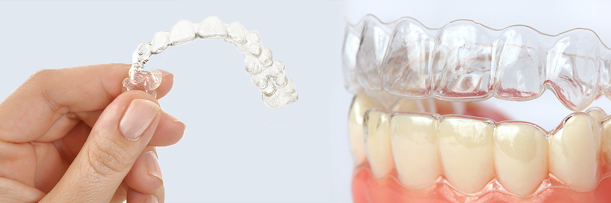 Flushing Alternative to Braces for Teens
