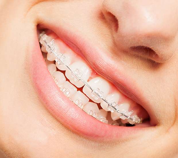 Flushing Invisible Orthodontics
