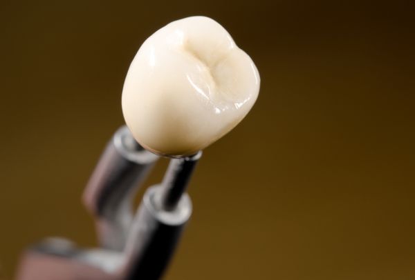 General Dentistry: What Is A Dental Crown?