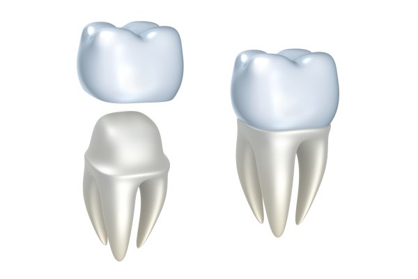 Cosmetic Dentistry Reasons To Choose Porcelain Crowns