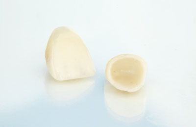 Dental Crowns