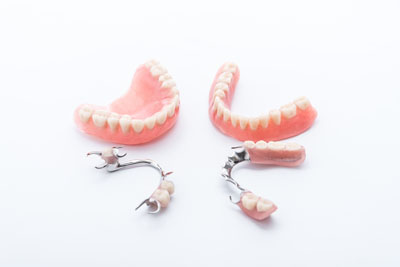 Questions To Ask Yourself If You Are Considering Implant Supported Dentures
