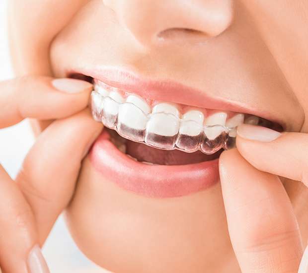 Flushing Does Invisalign® Really Work?