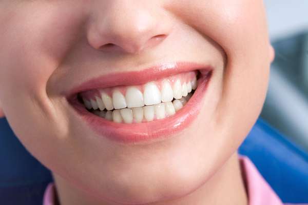 A General Dentist Discusses the Benefits of Tooth Straightening from Queens Family Dental in Flushing, NY